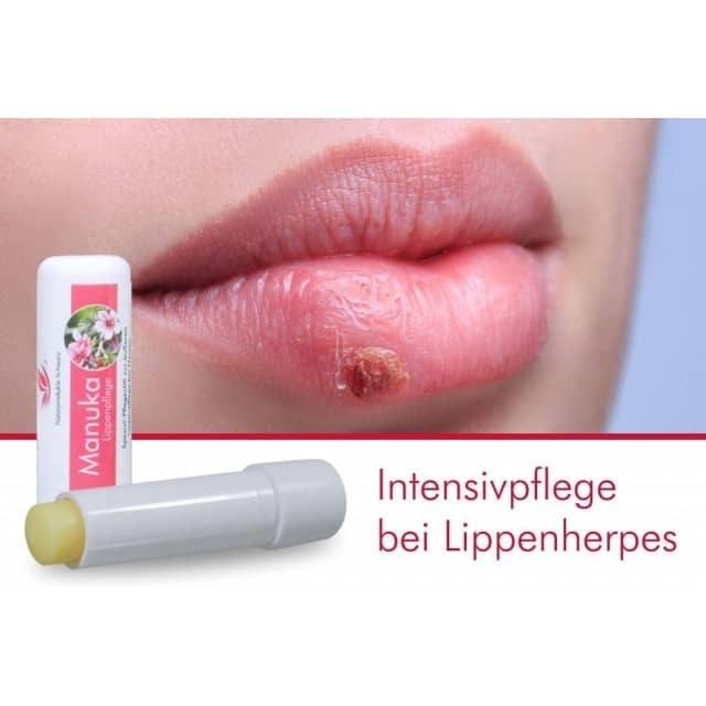 Manuka Lippenpflegestift Bei Herpes Erfahrungen Wirkung Anwendung